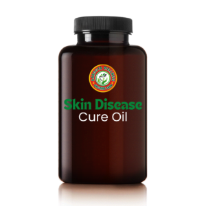 Skin Diseases Cure Oil